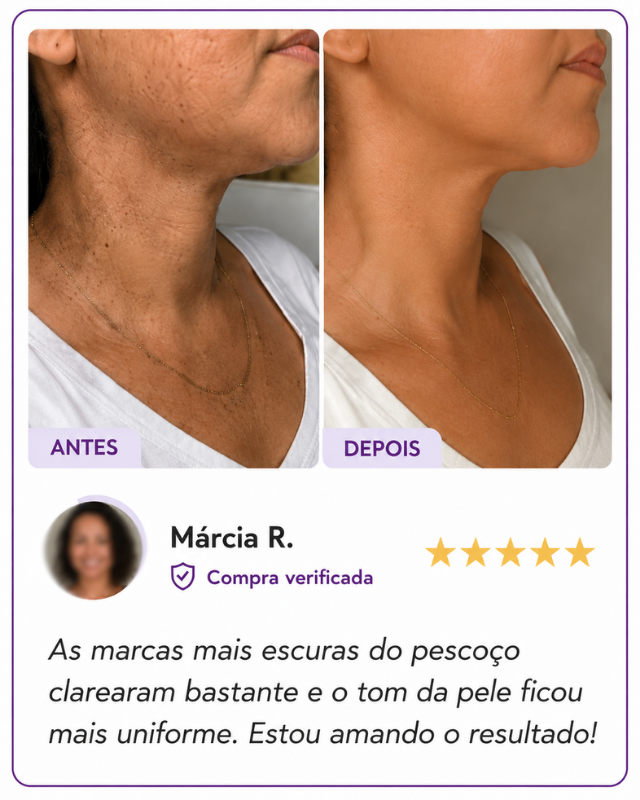 pvsocialrugasviareline5