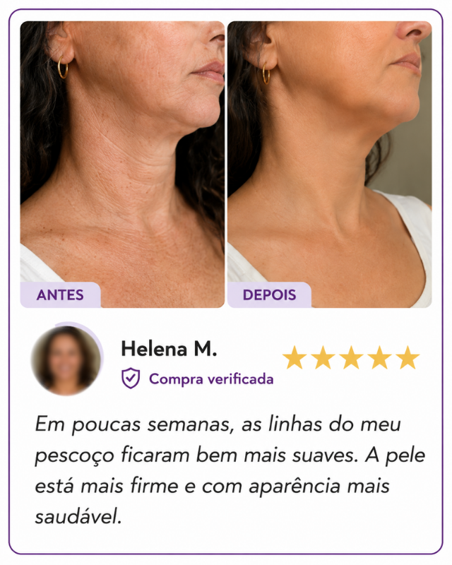 pvsocialrugasviareline6